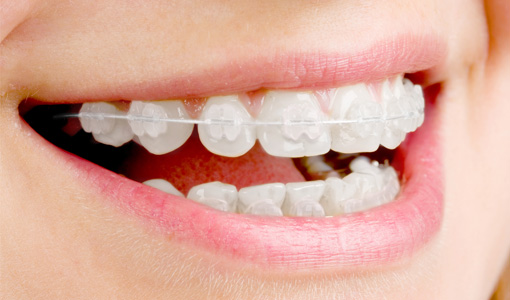 矯正歯科・小児矯正歯科