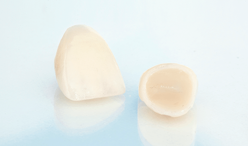 セラミックス治療